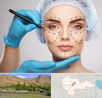 جراح فک و صورت در خاش