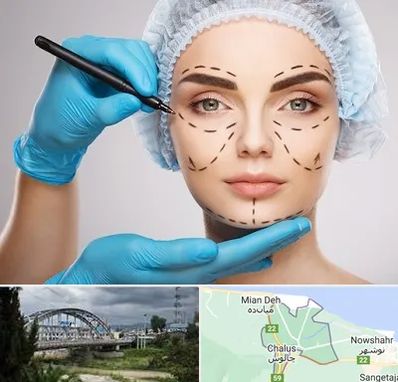 جراح فک و صورت در چالوس