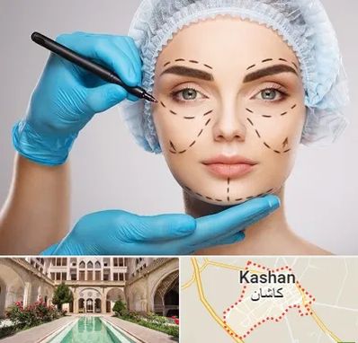 جراح فک و صورت در کاشان