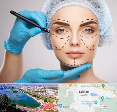 جراح فک و صورت در لاهیجان