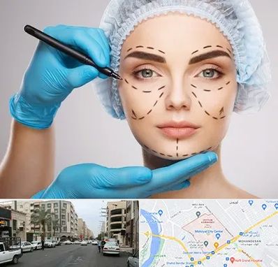 جراح فک و صورت در زیتون کارمندی اهواز