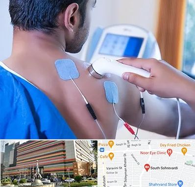 متخصص الکتروتراپی در سهروردی