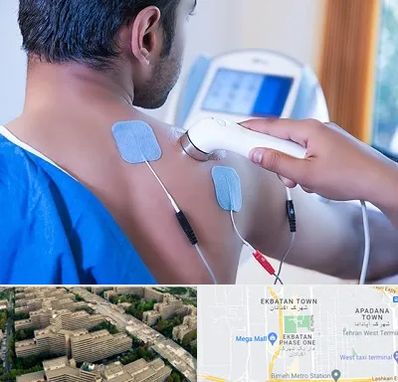 متخصص الکتروتراپی در اکباتان