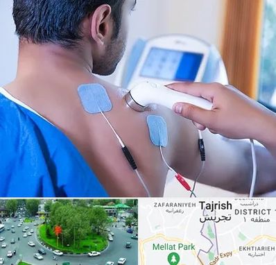 متخصص الکتروتراپی در تجریش