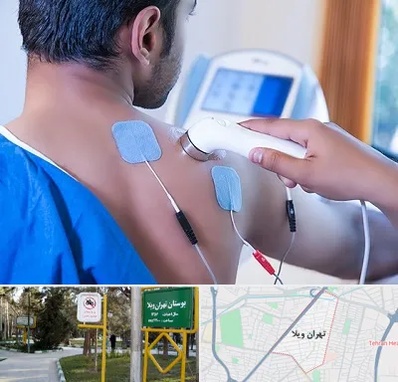 متخصص الکتروتراپی در تهران ویلا