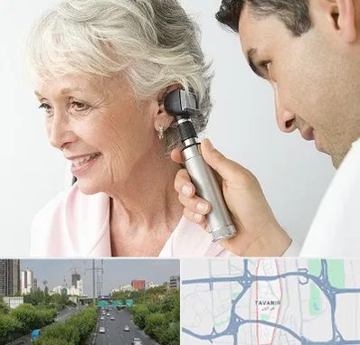 شنوایی سنجی در توانیر