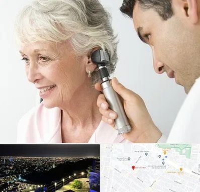 شنوایی سنجی در هفت تیر مشهد