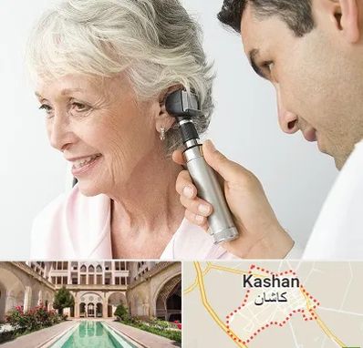 شنوایی سنجی در کاشان