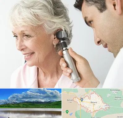 شنوایی سنجی در مرند