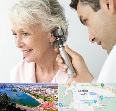 شنوایی سنجی در لاهیجان