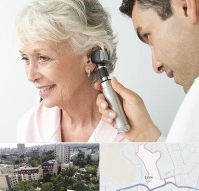 شنوایی سنجی در اوین