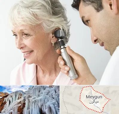 شنوایی سنجی در میگون