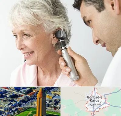 شنوایی سنجی در گنبد کاووس