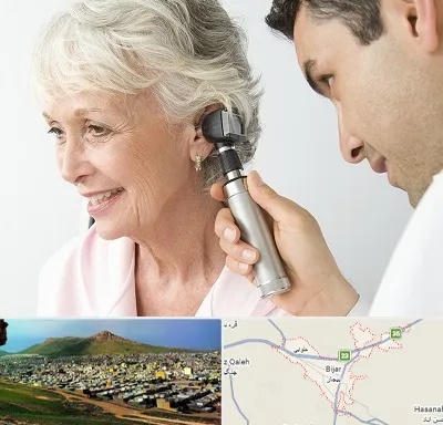 شنوایی سنجی در بیجار