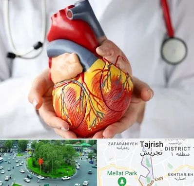 دکتر متخصص قلب و عروق در تجریش 