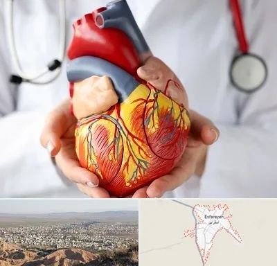 دکتر متخصص قلب و عروق در اسفراین