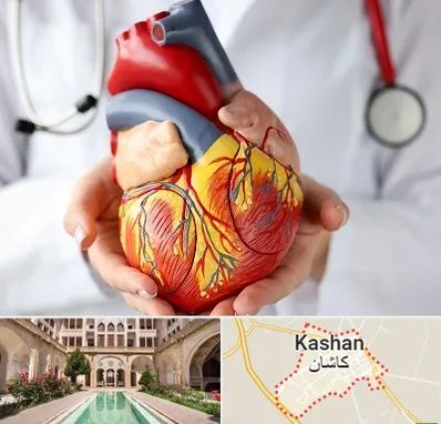 دکتر متخصص قلب و عروق در کاشان