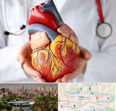 دکتر متخصص قلب و عروق در منطقه 1 تهران 