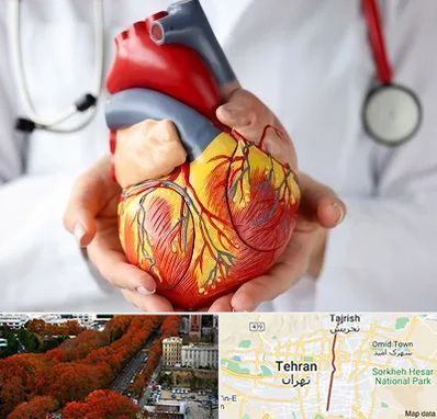 دکتر متخصص قلب و عروق در ولیعصر 