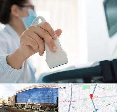 اکوی قلب در نصف راه تبریز