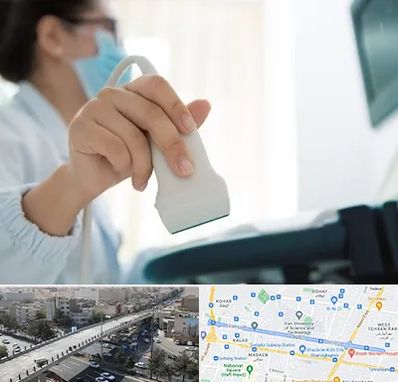 اکوی قلب در فرجام