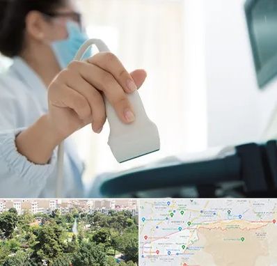 اکوی قلب در منطقه 13 تهران 