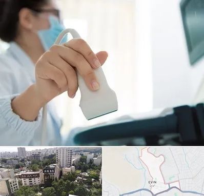 اکوی قلب در اوین