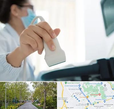 اکوی قلب در قدوسی غربی شیراز