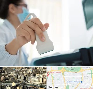 اکوی قلب در مرزداران 