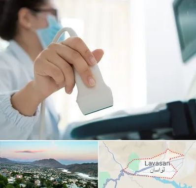 اکوی قلب در لواسان