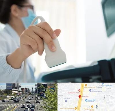 اکوی قلب در ستاری