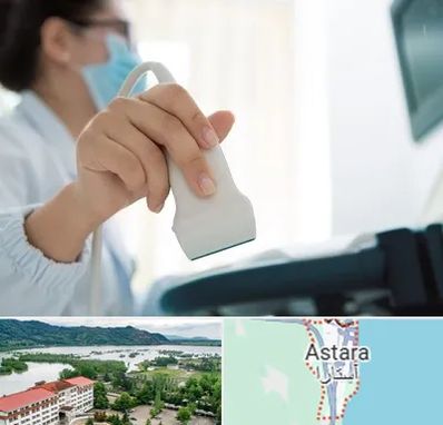 اکوی قلب در آستارا