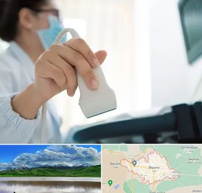 اکوی قلب در مرند