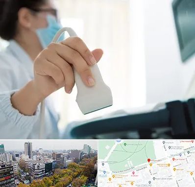 اکوی قلب در بلوار کشاورز