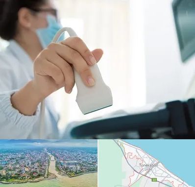 اکوی قلب در تنکابن
