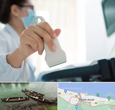 اکوی قلب در بندر انزلی