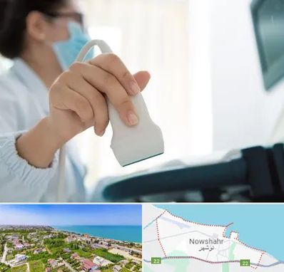 اکوی قلب در نوشهر