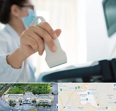 اکوی قلب در نسیم شهر