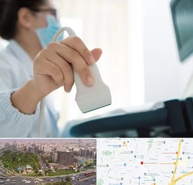 اکوی قلب در آیت الله کاشانی