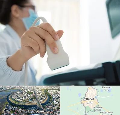 اکوی قلب در بابل