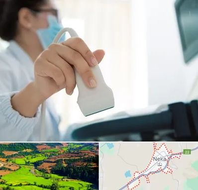 اکوی قلب در نکا