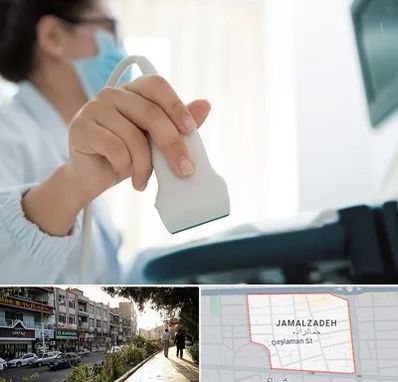 اکوی قلب در خیابان جمالزاده