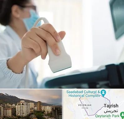 اکوی قلب در زعفرانیه 