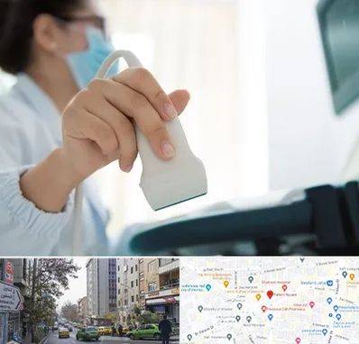 اکوی قلب در فاطمی