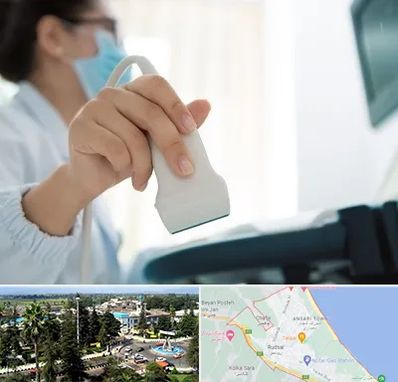 اکوی قلب در رودسر