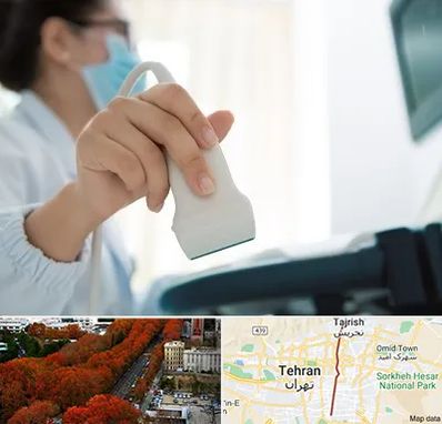 اکوی قلب در ولیعصر 