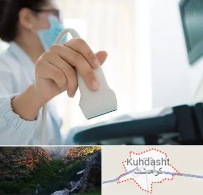 اکوی قلب در کوهدشت