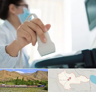 اکوی قلب در خاش