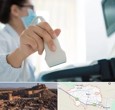 اکوی قلب در بم