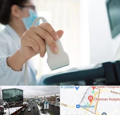 اکوی قلب در اقدسیه 